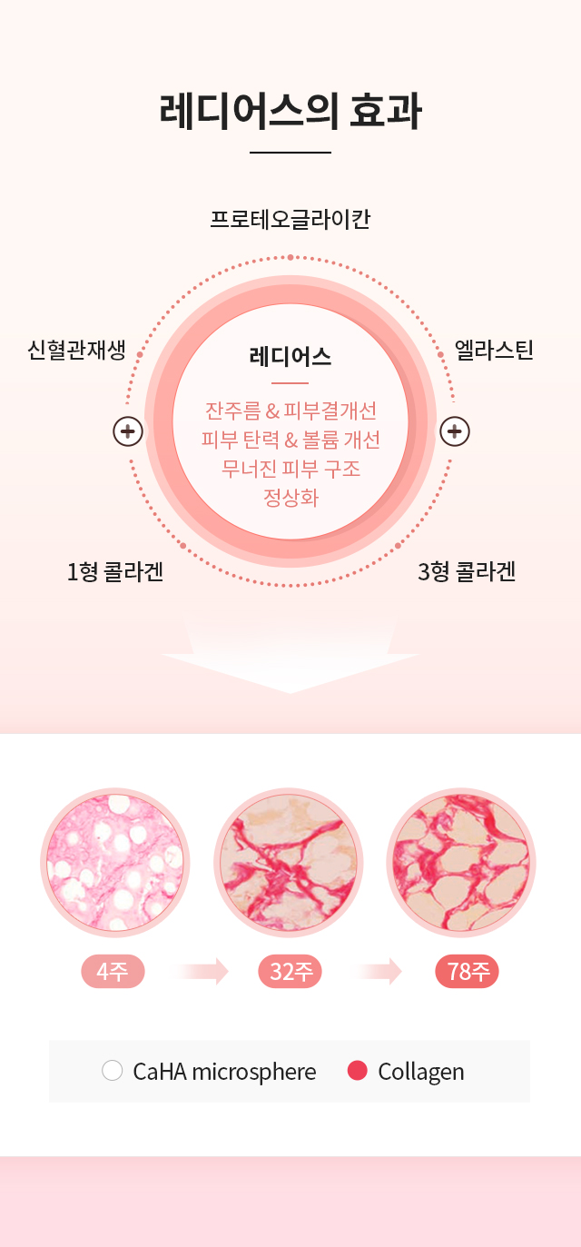 레디어스의 효과