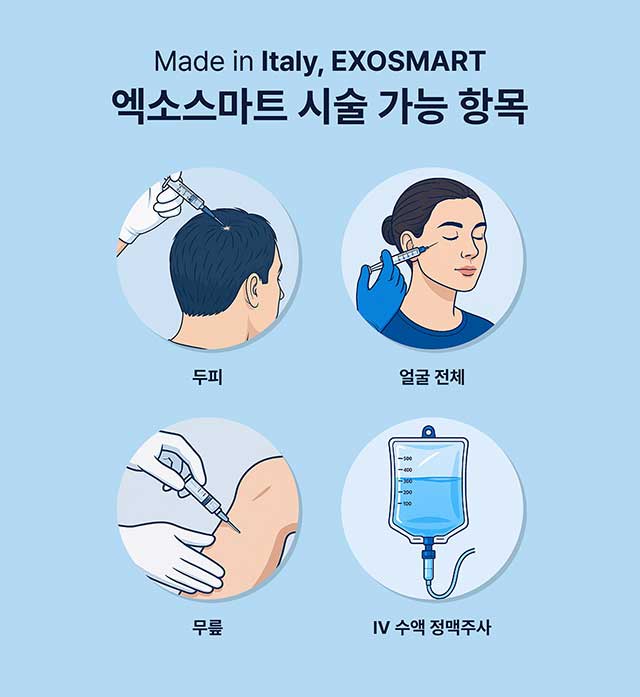 자가 엑소좀-엑소스마트 시술가능 항목