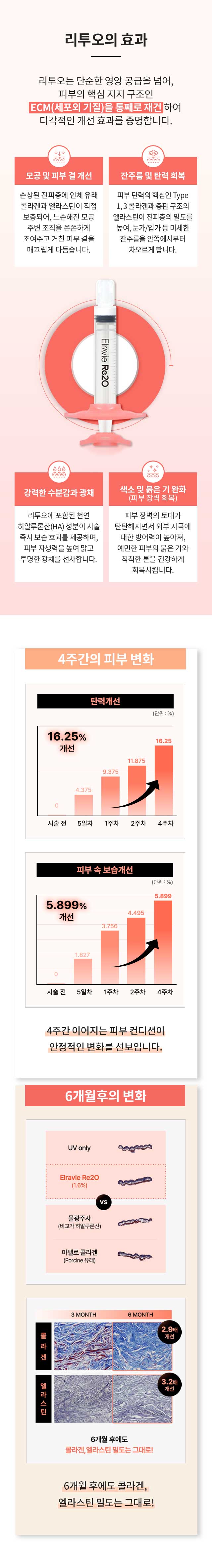 ?섎씪鍮꾩뿉 由ы닾?ㅼ쓽 ?④낵 : 由ы닾?ㅻ뒗 ?⑥닚???곸뼇 怨듦툒???섏뼱, ?쇰????듭떖 吏吏 援ъ“??ECM(?명룷??湲곗쭏)???듭㎏濡??ш굔?섏뿬 ?ㅺ컖?곸씤 媛쒖꽑 ?④낵瑜?利앸챸?⑸땲??